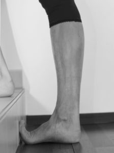 Dehnung der Plantarfaszie – Ausgangsstellung