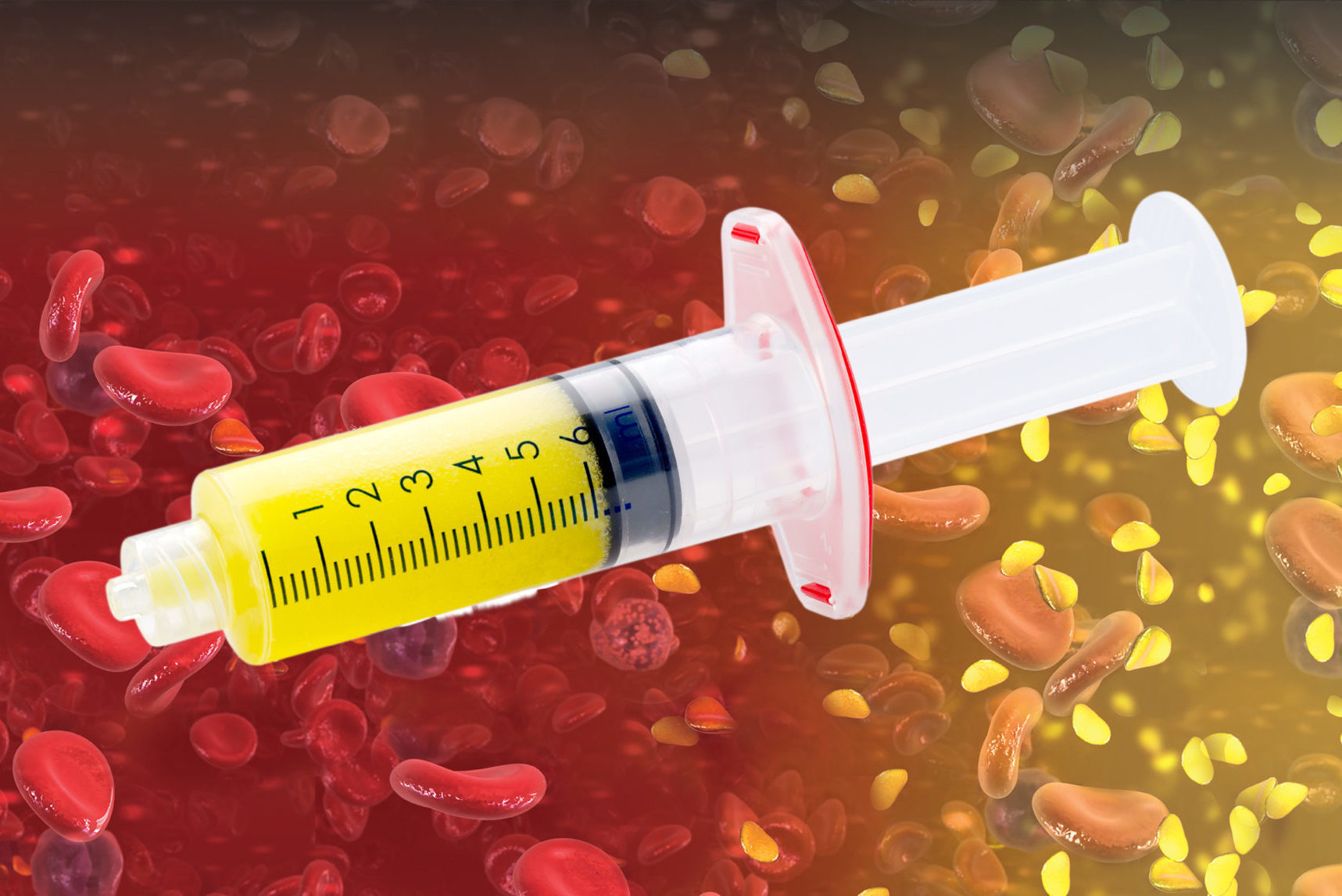 ACP – Autologes Conditioniertes Plasma