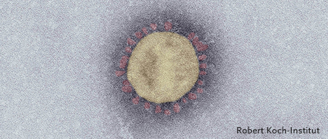COVID-19 (SARS-CoV-2)